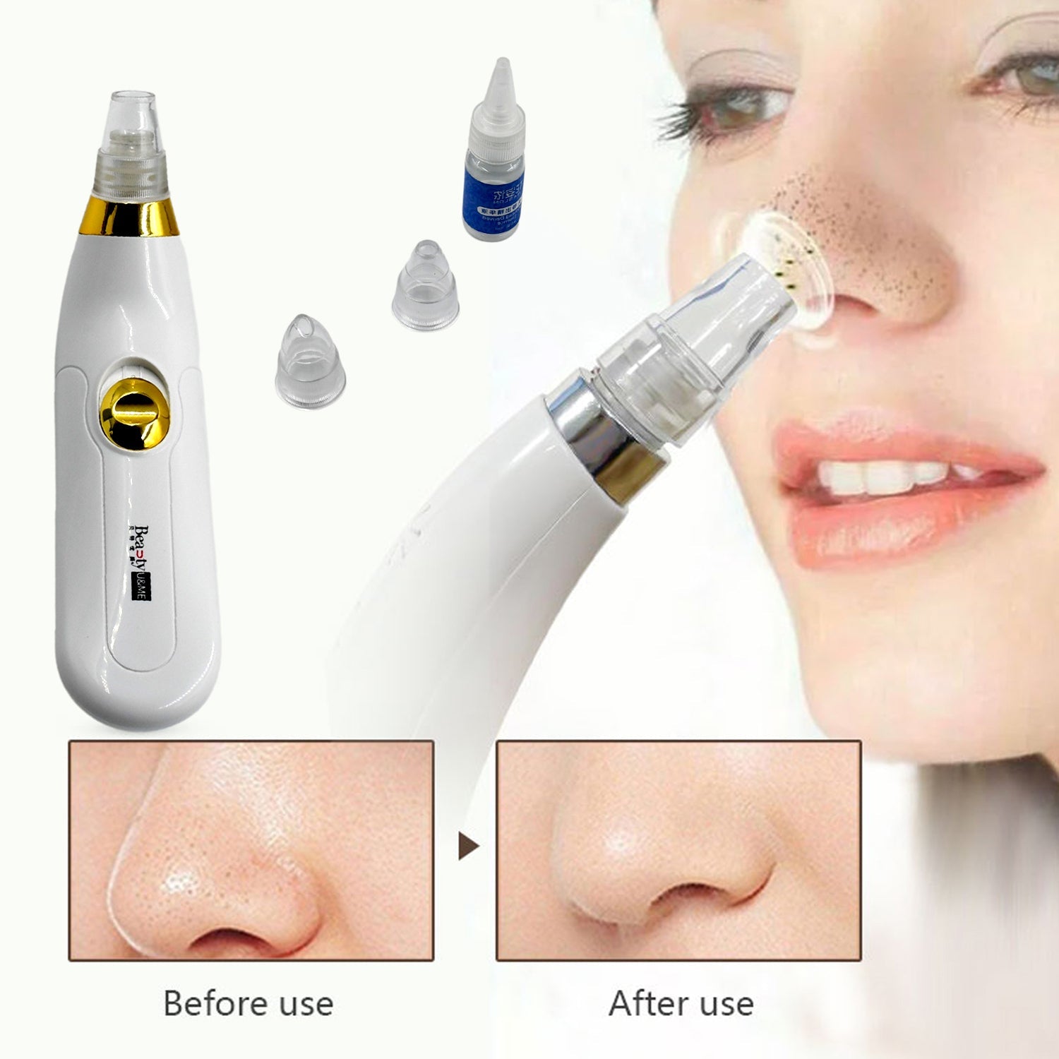 0351B Vacuum Blackhead Cleaner, 3 Suction Level Adjustable Electric Pore Cleaner Equipment With Replaceable Suction Head, For Skin Care