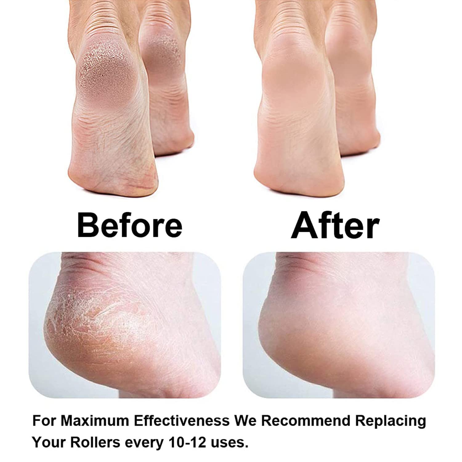 Callus Remover Rechargeable Pedicure Tool for Dead Skin |Foot Roller Callus Remover Hard and Dead Skin Remover |Feet Care Callus Remover | Pedicure for Hard Cracked Skin, Foot Scrubber Roller